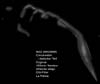 � M. D�hne; NGC 6992 / 95